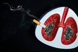 https://hellosehat.com/hidup-sehat/berhenti-merokok/bahaya-merokok-pada-daya-tahan-tubuh/